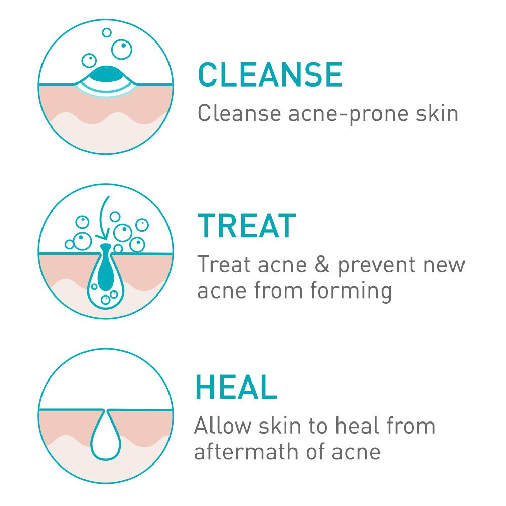 CeraVe Acne Foaming Cream Wash