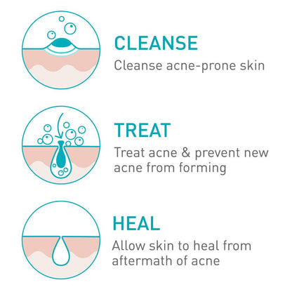 CeraVe Acne Foaming Cream Wash